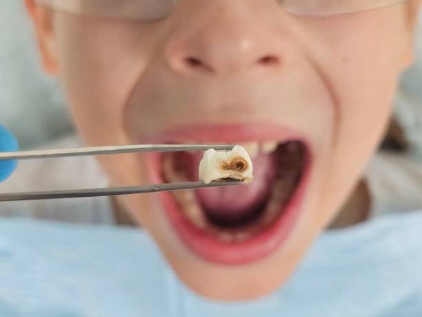 Best Pediatric Emergency Dentist in Columbus, MN