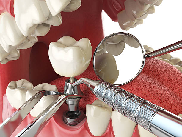 Best Cosmetic Emergency Dentistry in Columbus, MN